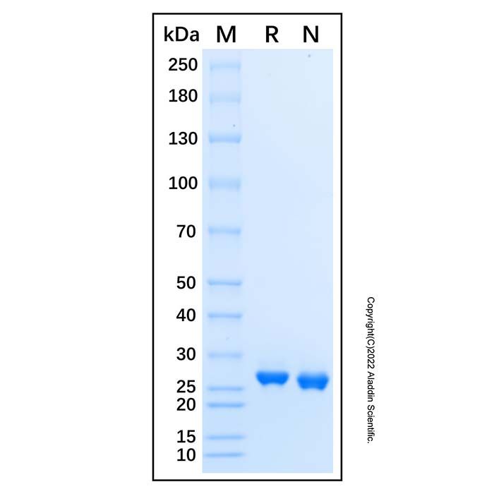 Recombinant Human DGCR6L Protein -    by Aladdin Scientific