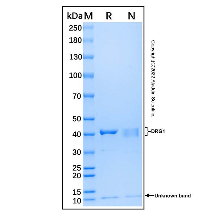 Recombinant Human DRG1 Protein -    by Aladdin Scientific