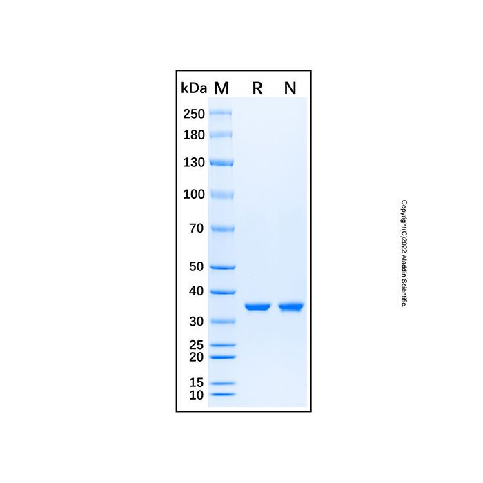 Recombinant Human DTNBP1 Protein  -    by Aladdin Scientific