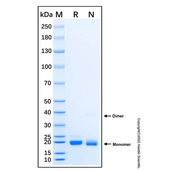 Recombinant Human DUSP22 Protein -    by Aladdin Scientific