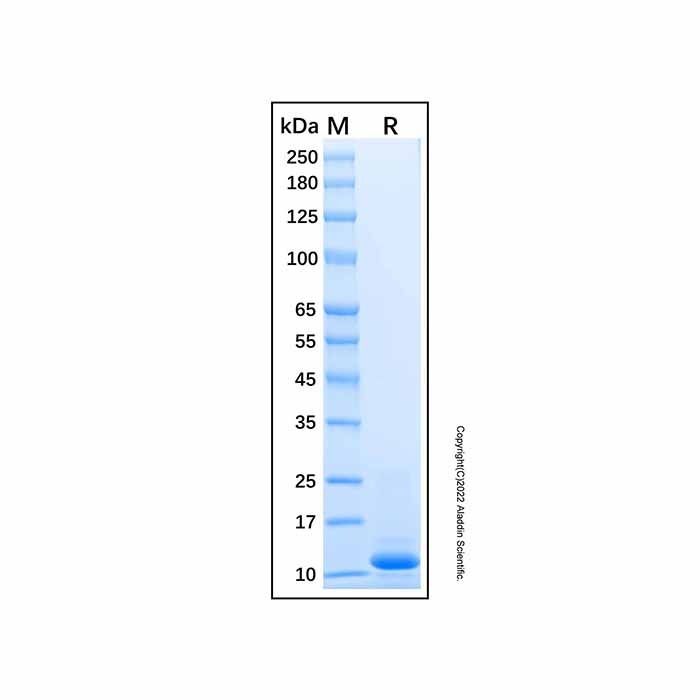 Recombinant Human Dynein Protein -    by Aladdin Scientific