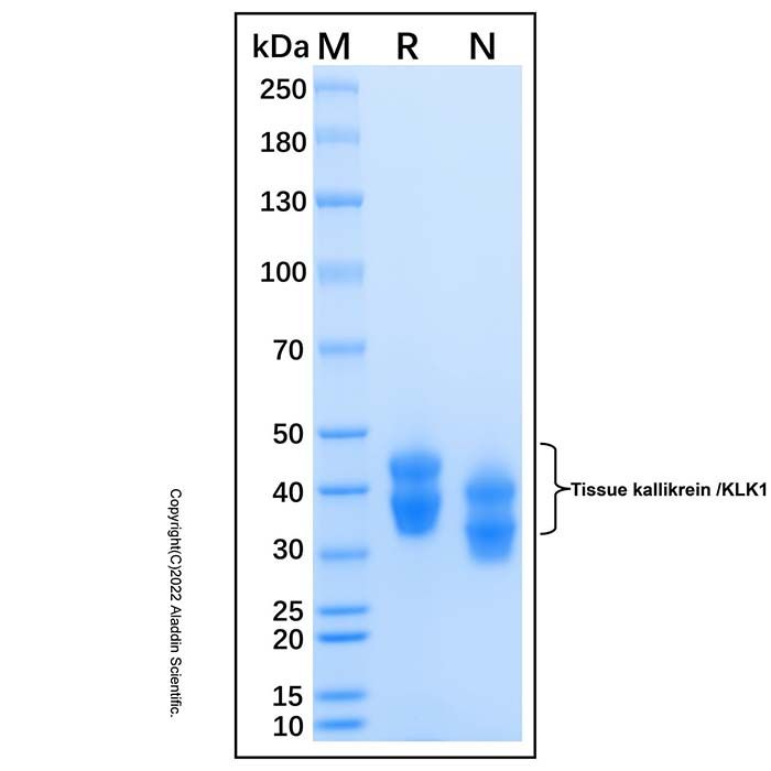 Recombinant Human Kallikrein 1 Protein -    by Aladdin Scientific