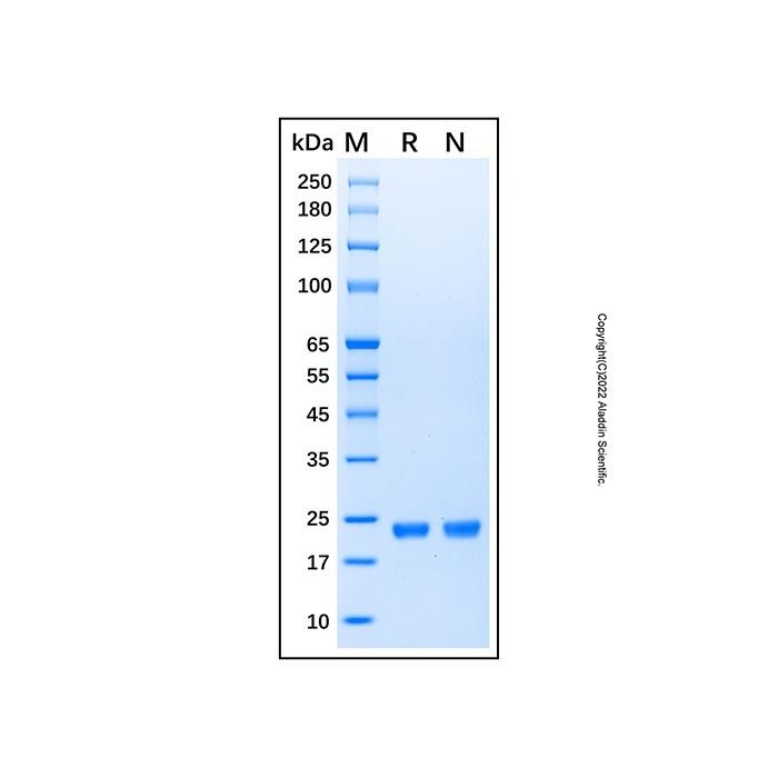 Recombinant Human KRAS (G12A) Protein -    by Aladdin Scientific
