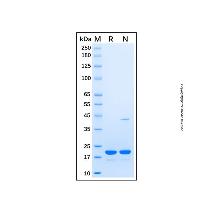 Recombinant Human Lamin B1 Protein -    by Aladdin Scientific