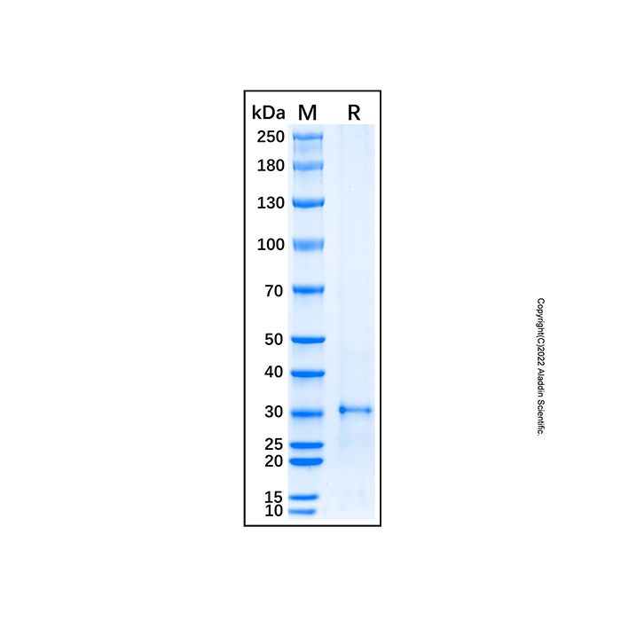 Recombinant Human EIF2B1 Protein  -    rp192073 by Aladdin Scientific