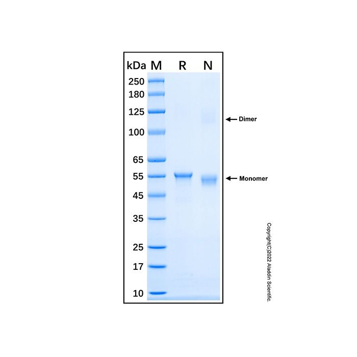 Recombinant Human ETS2 Protein -    by Aladdin Scientific
