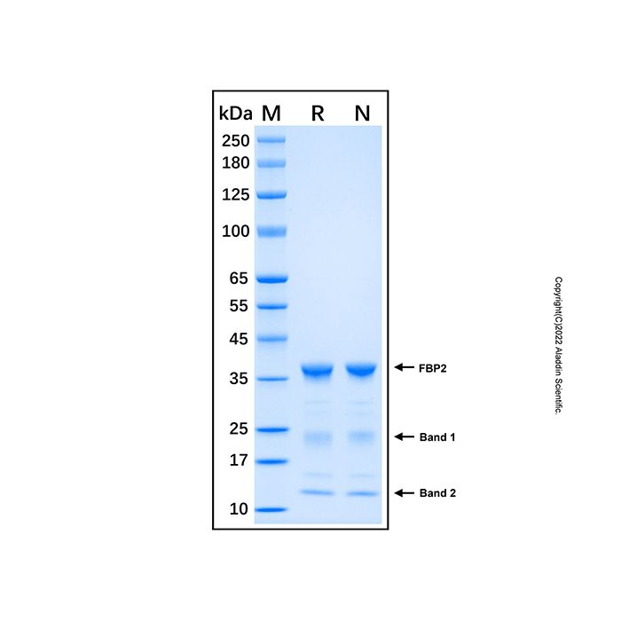 Recombinant Human FBP2 Protein -    by Aladdin Scientific