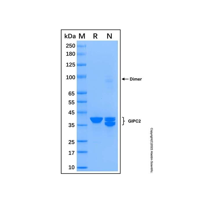 Recombinant Human GIPC2 Protein -    by Aladdin Scientific