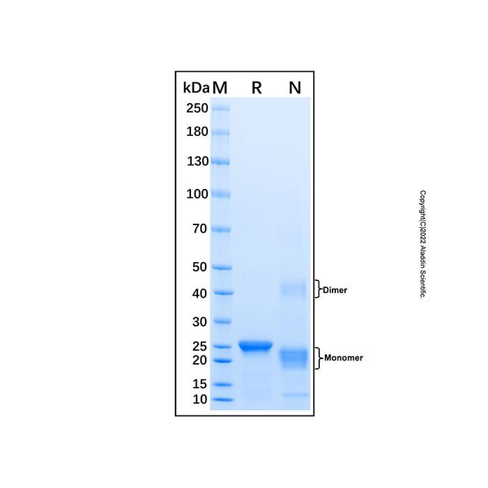Recombinant Human Glutathione Peroxidase 1/GPX1 Protein -    rp192119 by Aladdin Scientific
