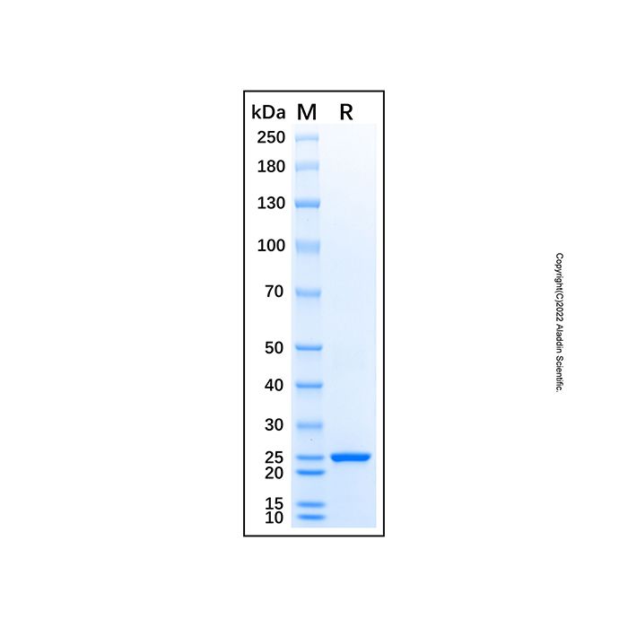 Recombinant Human HLA-DOB Protein -    by Aladdin Scientific
