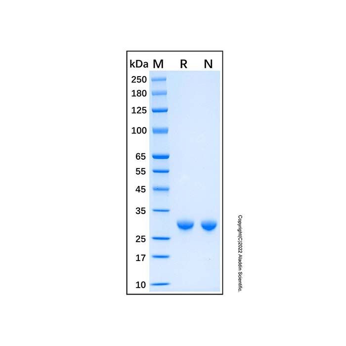 Recombinant Human KCNIP3 Protein -    by Aladdin Scientific