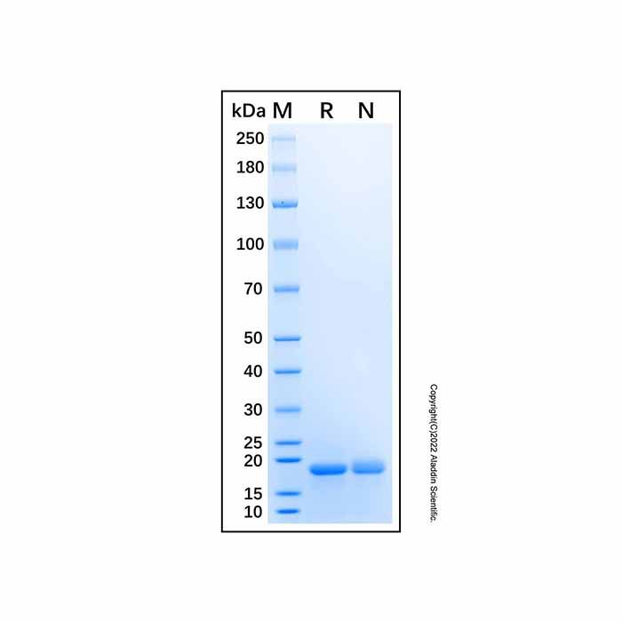 Recombinant Human PPP3R2 Protein - Recombinant protein   by Aladdin Scientific