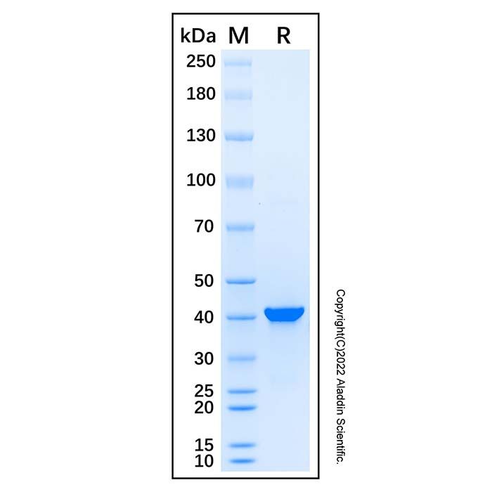 Recombinant Human PSMD13 Protein -    by Aladdin Scientific