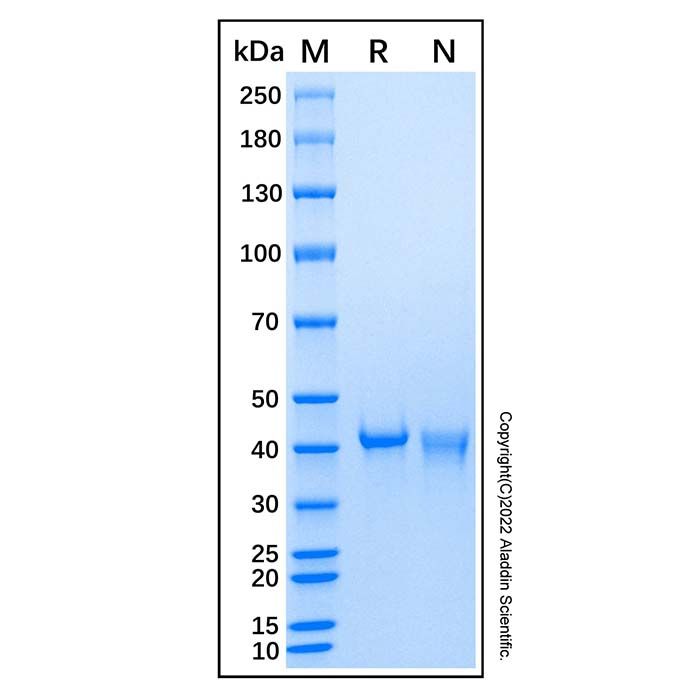 Recombinant Human PTPN7 Protein -    by Aladdin Scientific