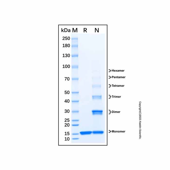 Recombinant Human PTRHD1 Protein -    by Aladdin Scientific
