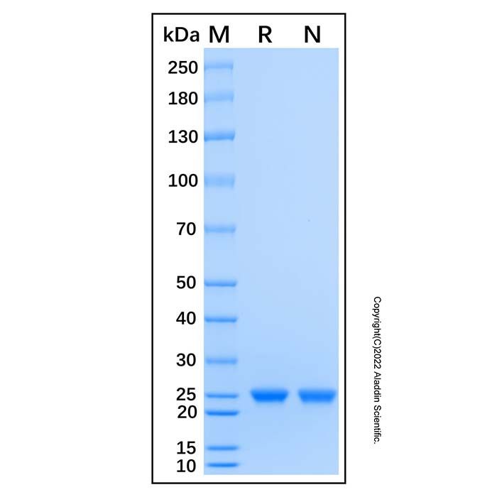 Recombinant Human RAB1A Protein -    by Aladdin Scientific