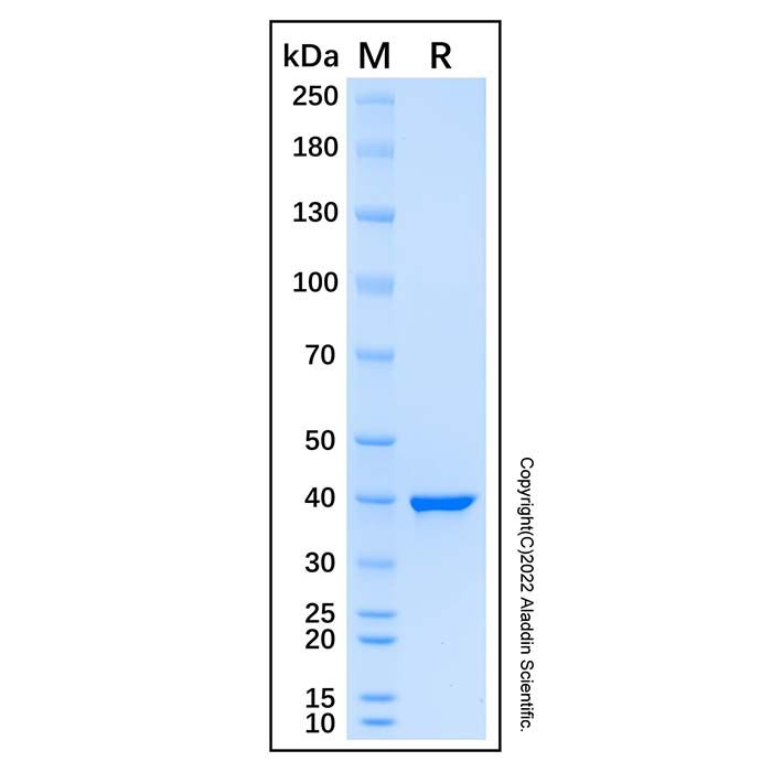 Recombinant Human RAD51B Protein -    by Aladdin Scientific