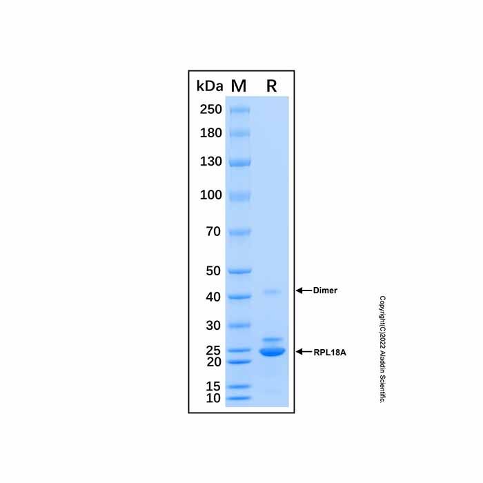 Recombinant Human RPL18A Protein -    by Aladdin Scientific