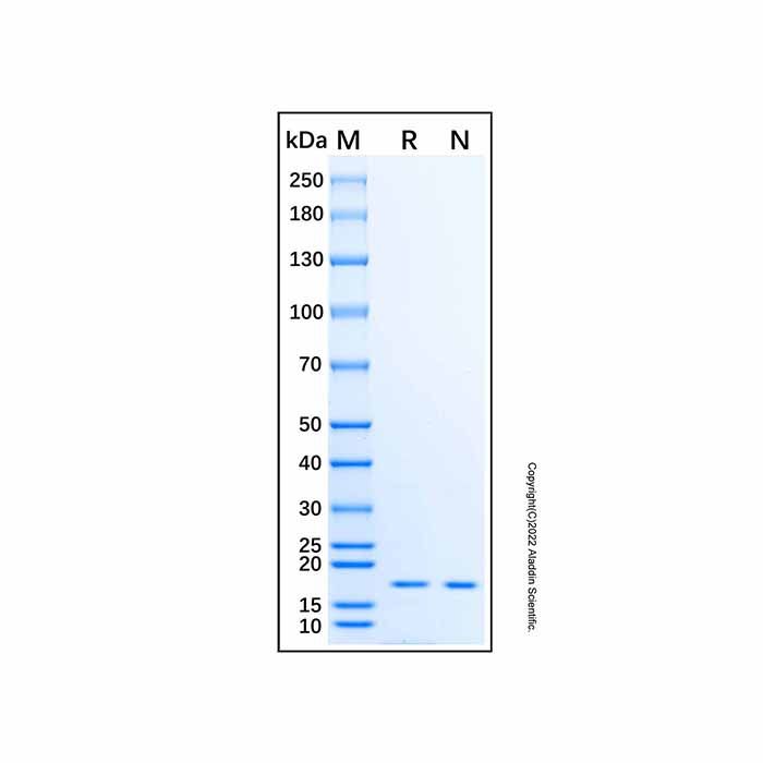 Recombinant Human RPS14 Protein - Recombinant protein   by Aladdin Scientific
