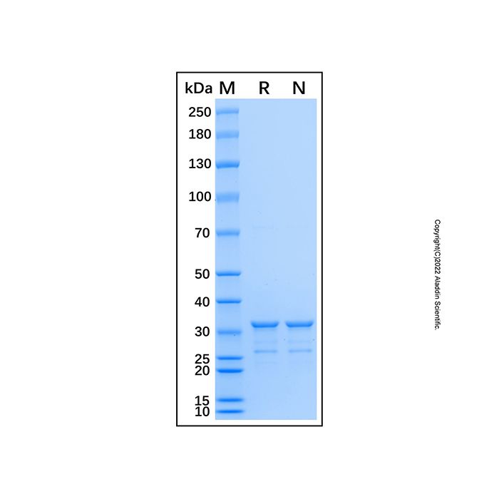Recombinant Human RWDD1 Rrotein  -    rp192227 by Aladdin Scientific