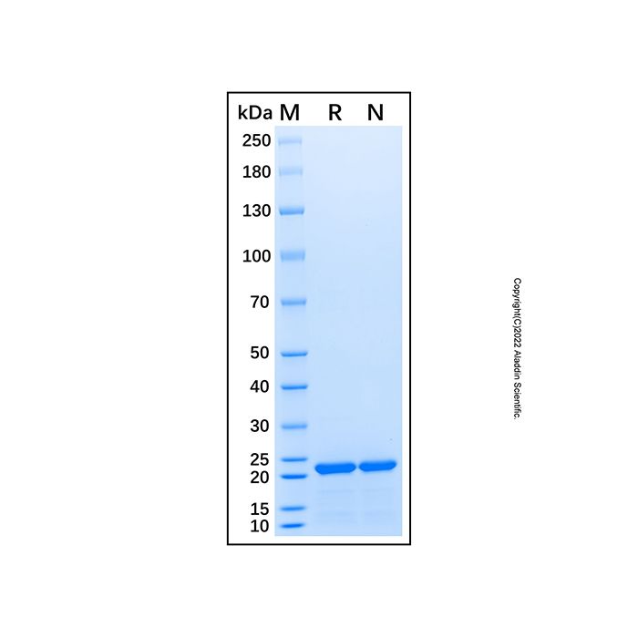 Recombinant Human RWDD4 Rrotein -    by Aladdin Scientific