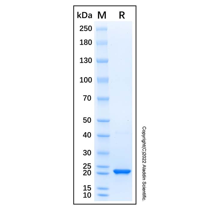Recombinant Human SEC22B Protein -    by Aladdin Scientific
