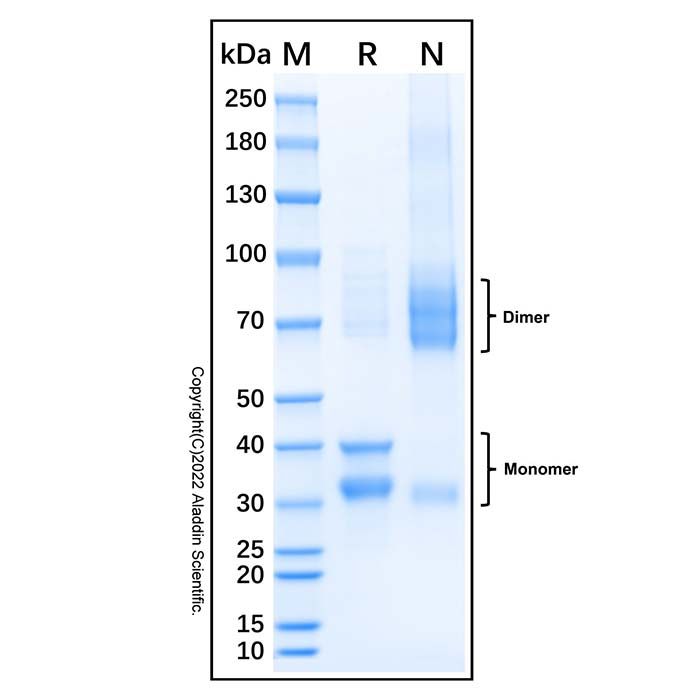 Recombinant Human SPECC1 Protein -    by Aladdin Scientific