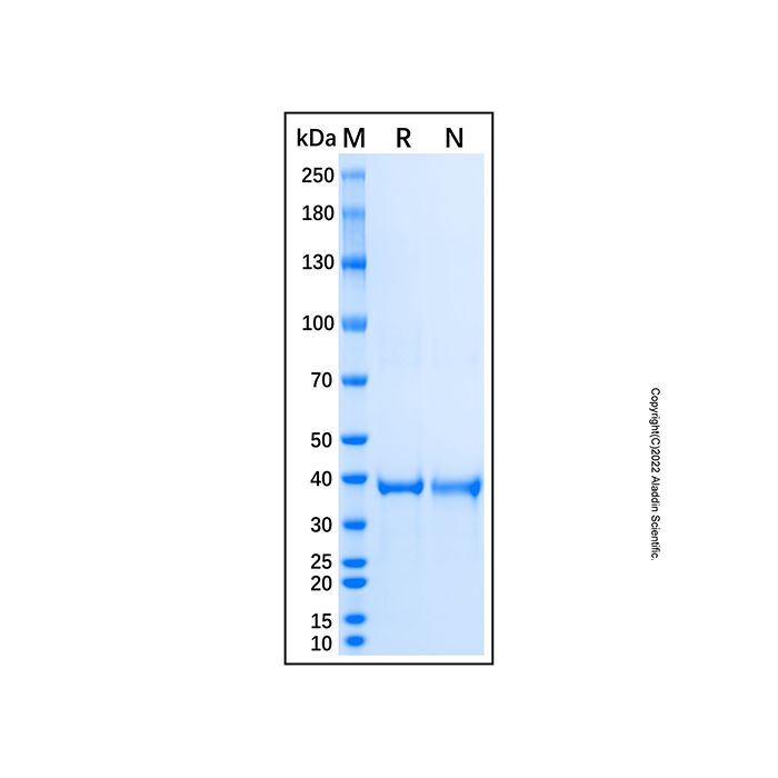 Recombinant Human SRR Protein -    by Aladdin Scientific