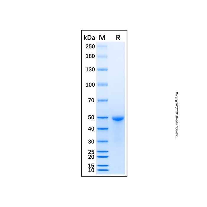 Recombinant Human UQCRC1 Protein -    rp192256 by Aladdin Scientific