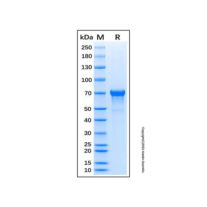 Recombinant Human Src Protein -    by Aladdin Scientific