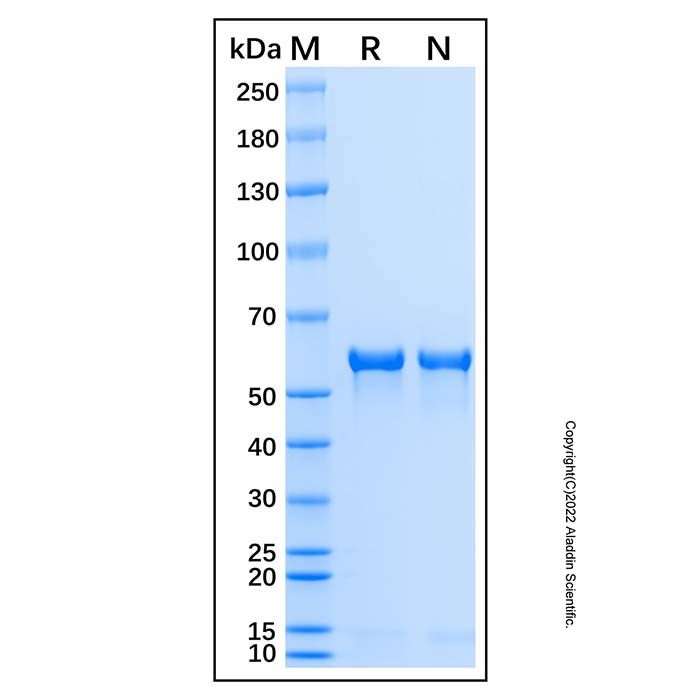 Recombinant Human Tyrosine Hydroxylase Protein  -    by Aladdin Scientific