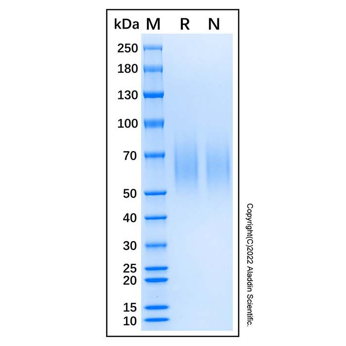 Recombinant Human LAMP-1/CD107a Protein -    by Aladdin Scientific