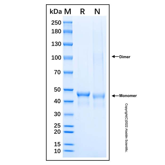 Recombinant Human GATA-1/GATA1 Protein -    by Aladdin Scientific