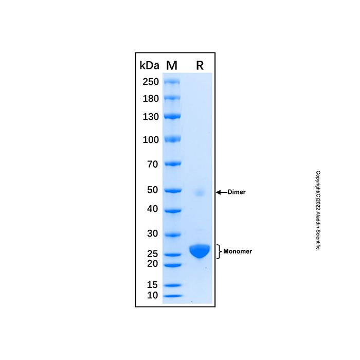 Recombinant Human GSTP1 Protein -    by Aladdin Scientific