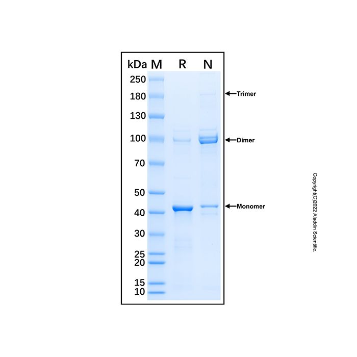 Recombinant Human GM130/GOLGA2 Protein -    by Aladdin Scientific