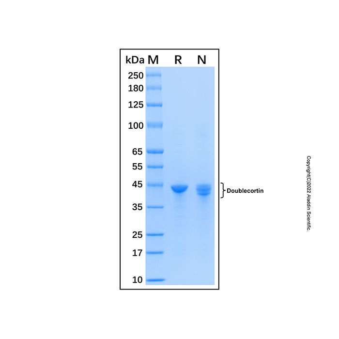 Recombinant Human Doublecortin Protein -    by Aladdin Scientific