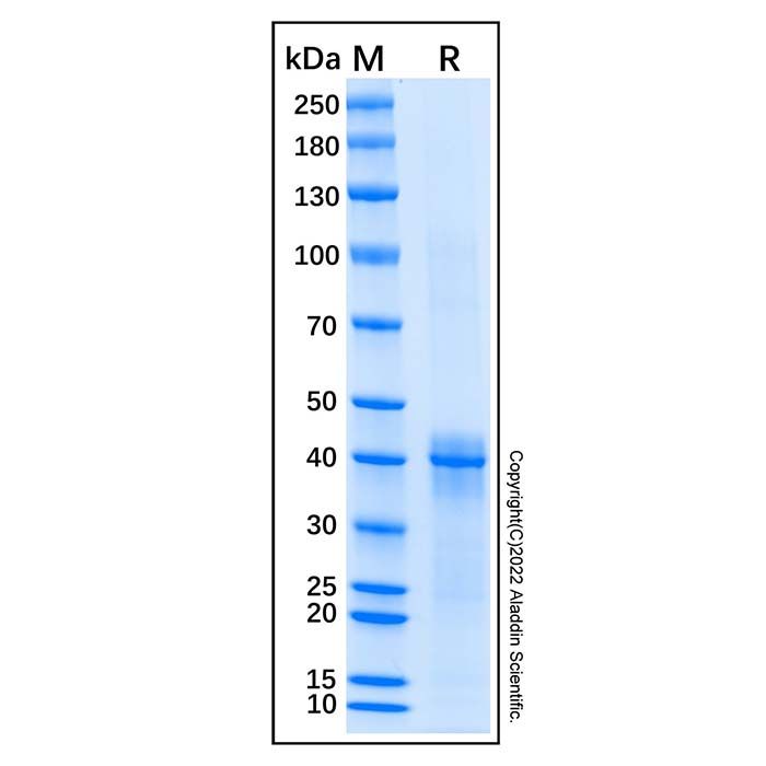 Recombinant Human PKC delta Protein -    by Aladdin Scientific