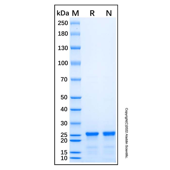 Recombinant Human ALK/CD246 Protein -    by Aladdin Scientific