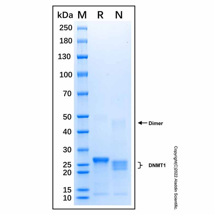 Recombinant Human DNMT1 Protein -    by Aladdin Scientific