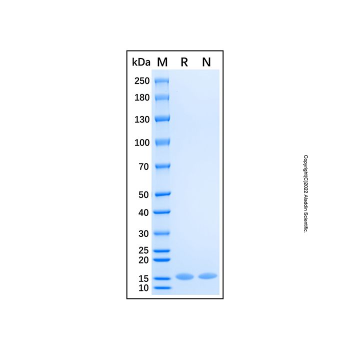 Recombinant Human ABL1 Protein -    rp217149 by Aladdin Scientific
