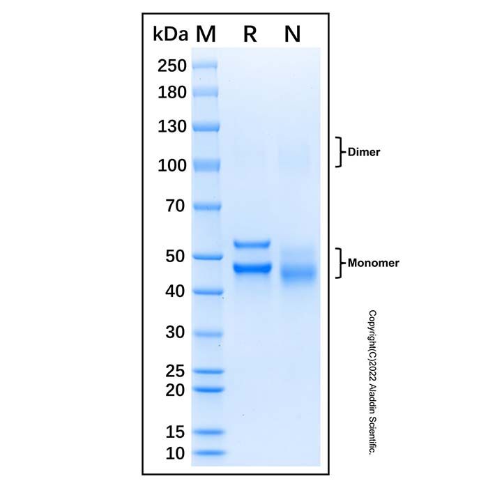 Recombinant Human NFKB2 Protein -    by Aladdin Scientific