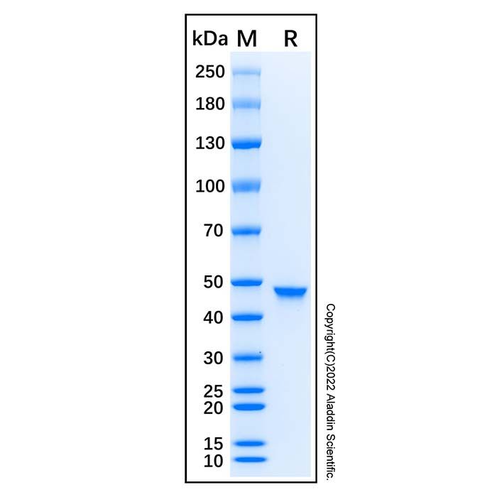 Recombinant Human IRF-9 Protein -    by Aladdin Scientific