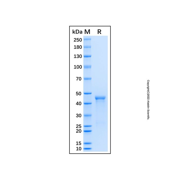 Recombinant Human HADHA Protein -    by Aladdin Scientific