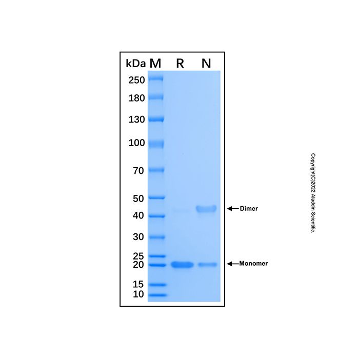 Recombinant Human DNMT3A Protein -    by Aladdin Scientific