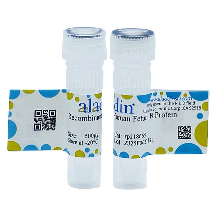 Recombinant Human Fetuin B Protein -    by Aladdin Scientific