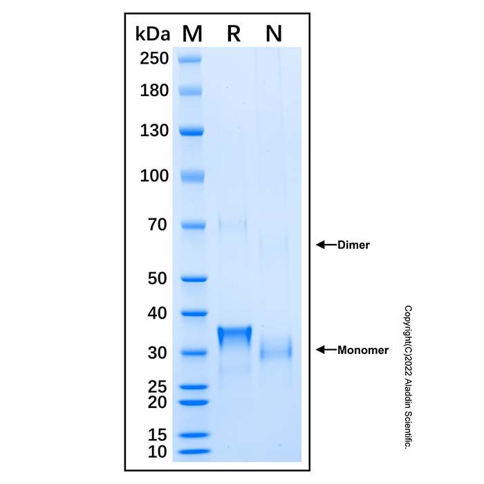 Recombinant Human Tyrosinase Protein -    by Aladdin Scientific