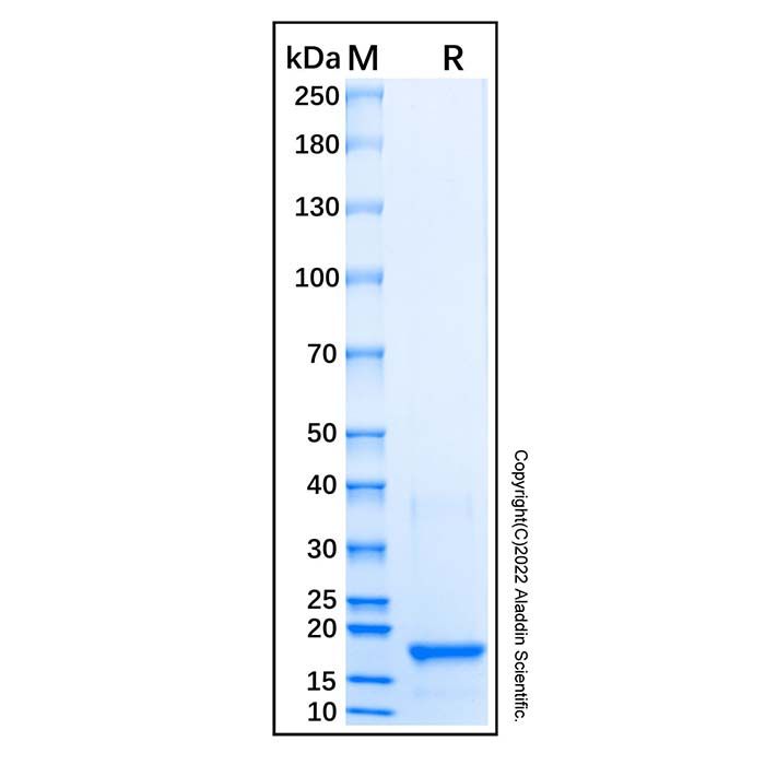 Recombinant Human Vitamin D Receptor/VDR Protein -    by Aladdin Scientific
