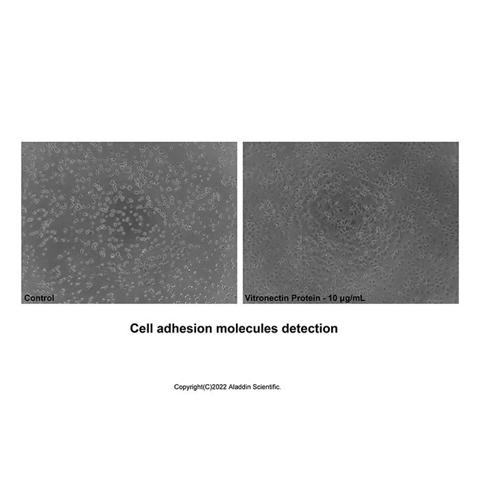 Recombinant Human Vitronectin Protein -    by Aladdin Scientific