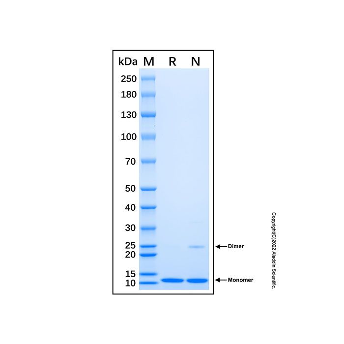 Recombinant Human XRCC1 Protein -    by Aladdin Scientific