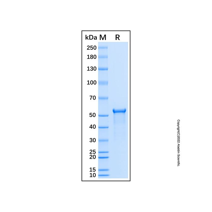 Recombinant Human Sphingosine Kinase 1/SPHK1 Protein -    by Aladdin Scientific